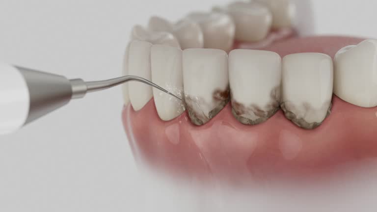 Trusted Invisalign Clear Aligners service in White Horse, NJ - Dentist Open Now